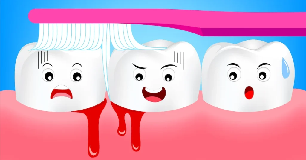 Is Bleeding Gums an Early Sign of Gum Disease Harlow?