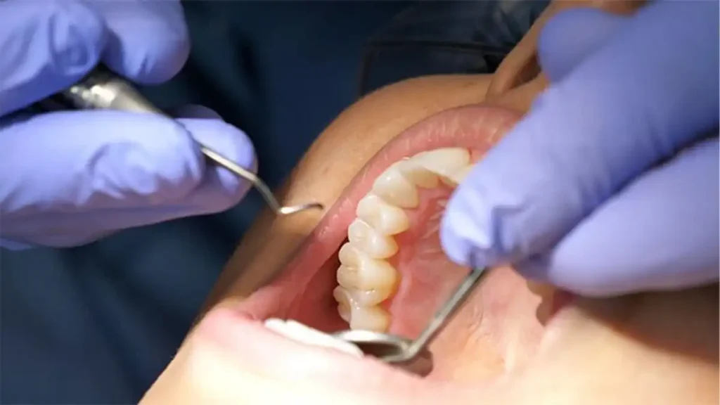 Teeth-friendly foods like apples and carrots that naturally help clean and whiten teeth Harlow