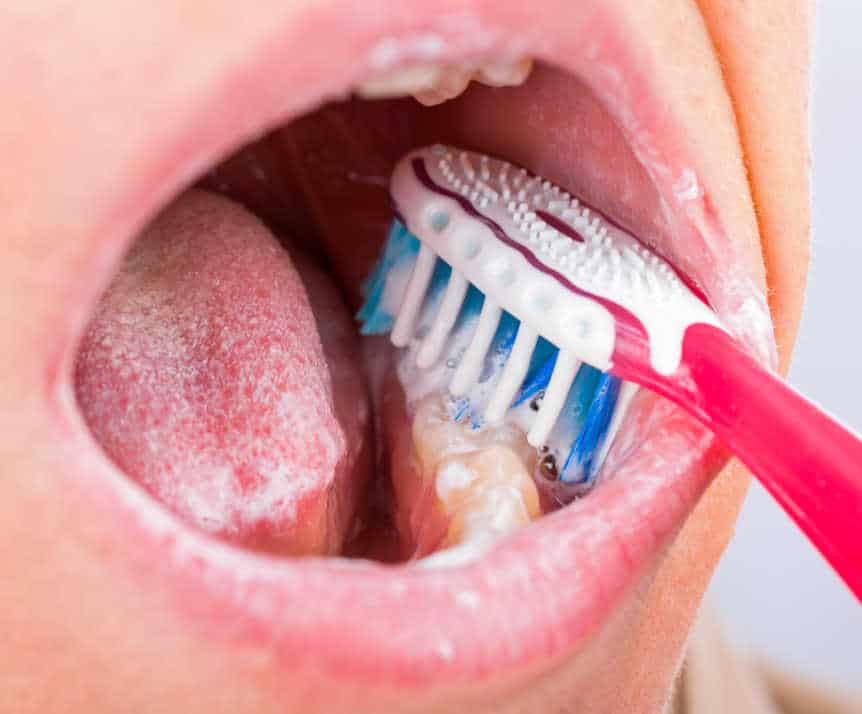 Proper oral hygiene tools, including toothbrush, floss, and mouthwash, essential for maintaining white teeth Harlow